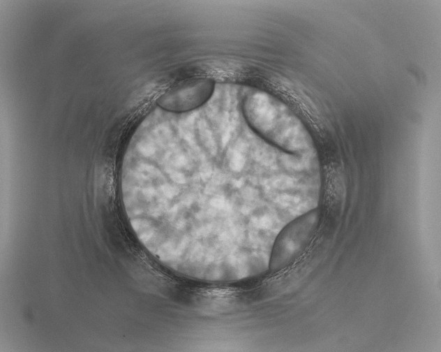 X0000115390313200912151505