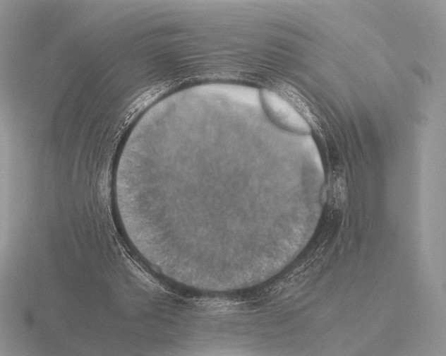 X0000115390389200912151504