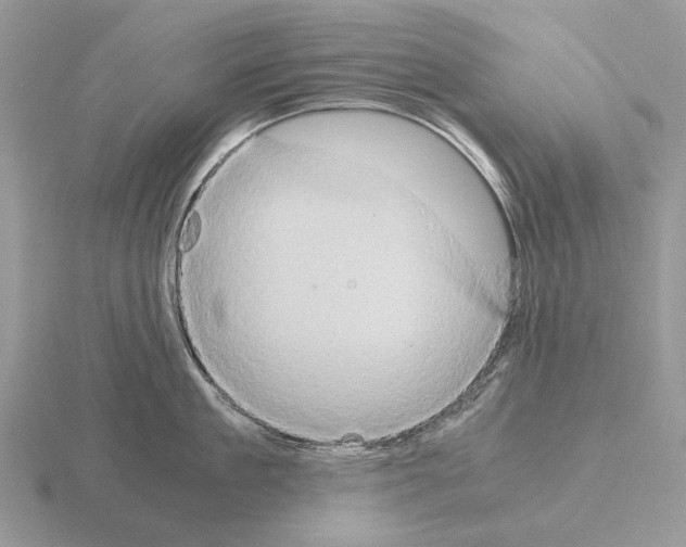 X0000115390909200912151457