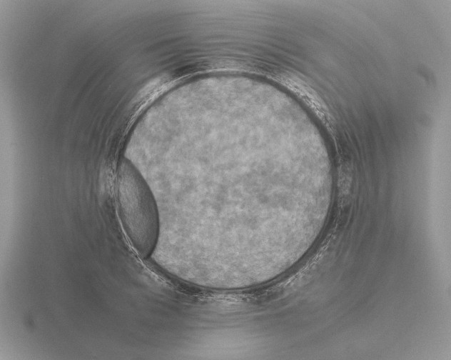 X0000115390993200912151456