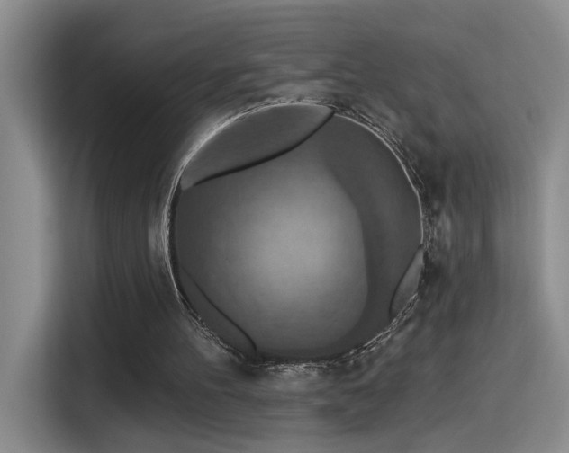 X0000115400100200911101520