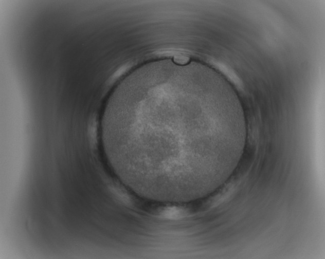 X0000115400111200911101520