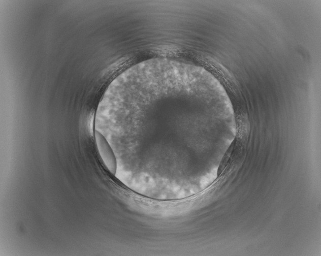 X0000115400047200912151529