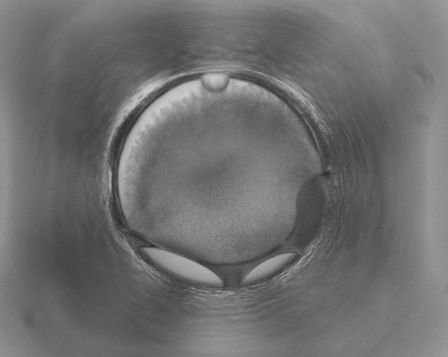 X0000115401414200912151511