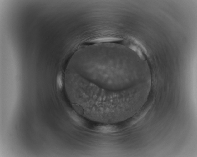 X0000115410069200911101620