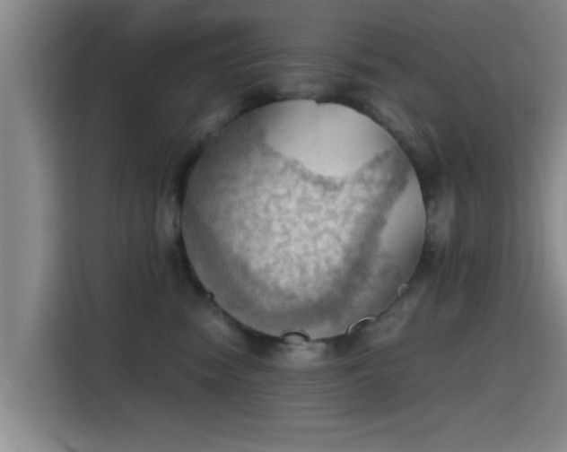 X0000115410474200911101615