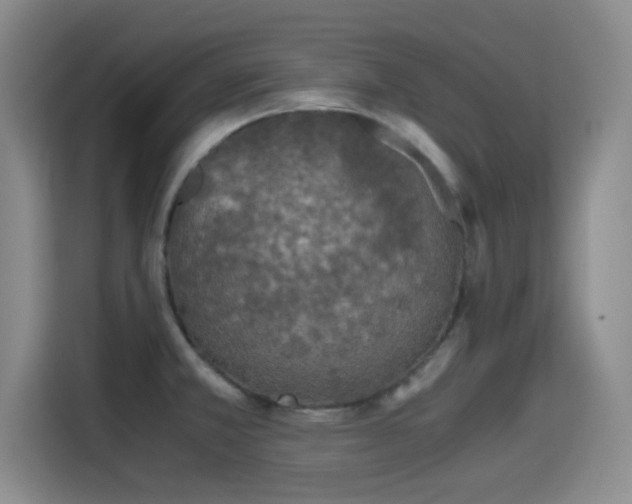 X0000115411381200911101603