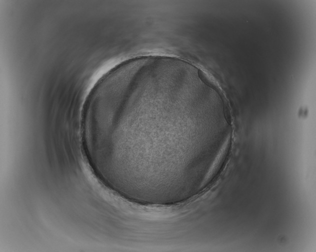 X0000115410008200911171410