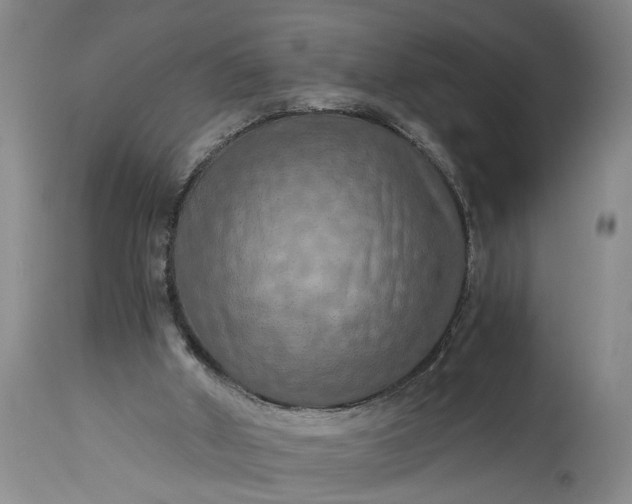 X0000115410010200911171410