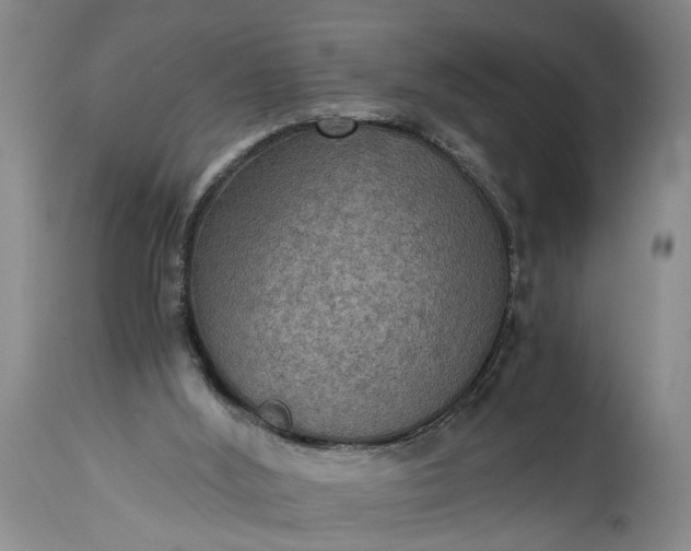 X0000115410012200911171410