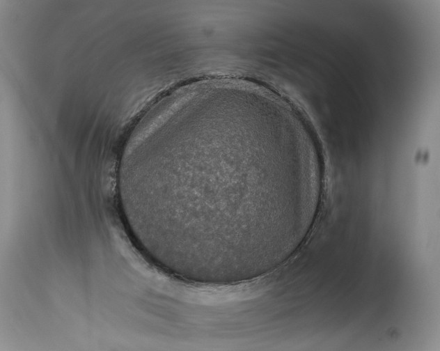 X0000115410017200911171410