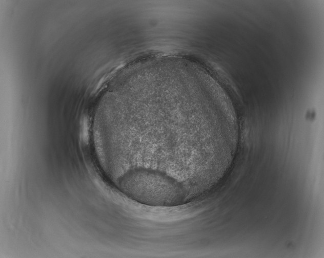 X0000115410026200911171410