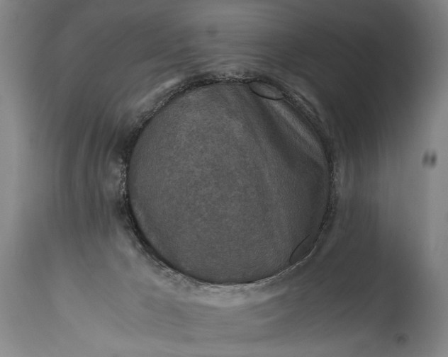 X0000115410029200911171410