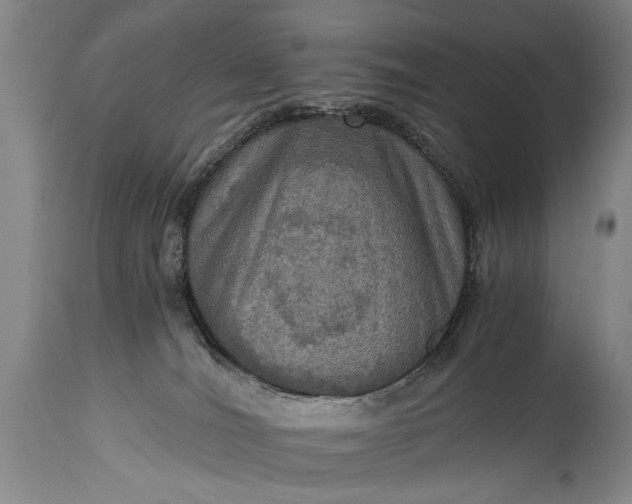 X0000115410036200911171410