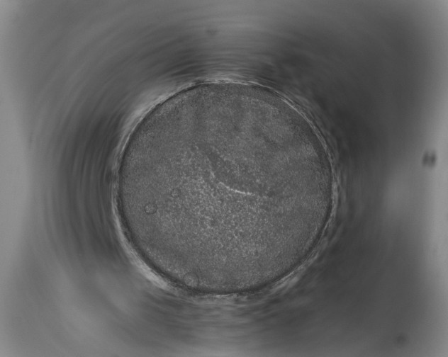 X0000115410049200911171409