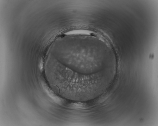 X0000115410069200911171409