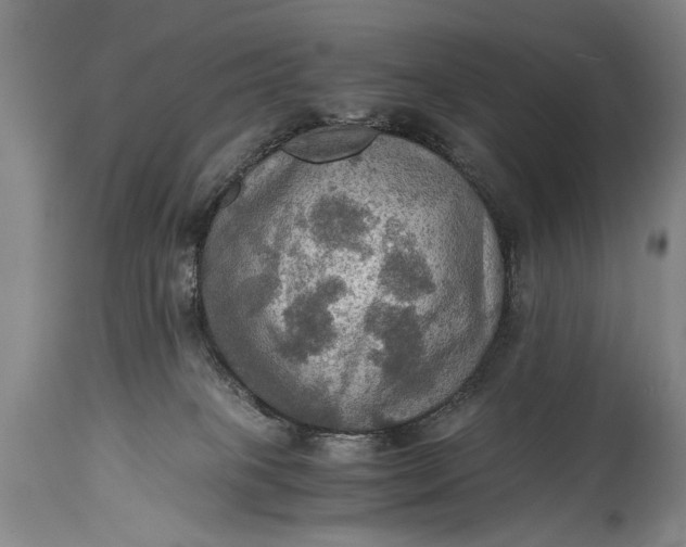 X0000115410085200911171410