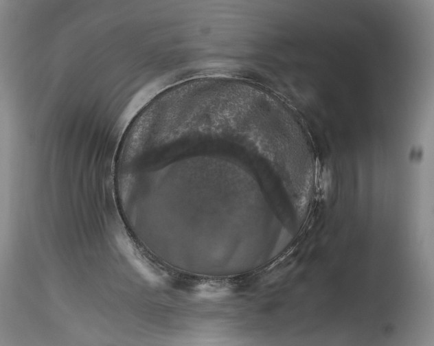 X0000115410099200911171409