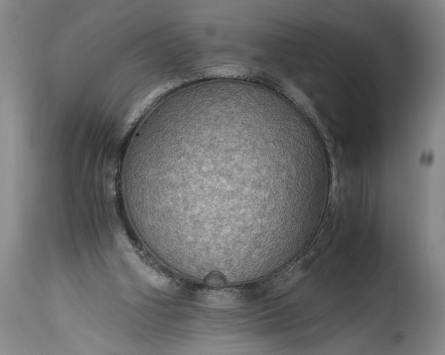 X0000115410106200911171409
