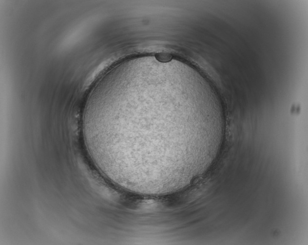 X0000115410111200911171409