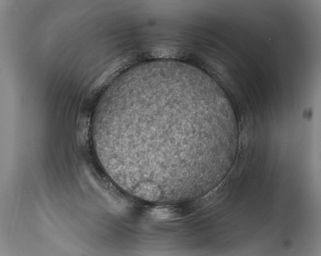 X0000115410171200911171408