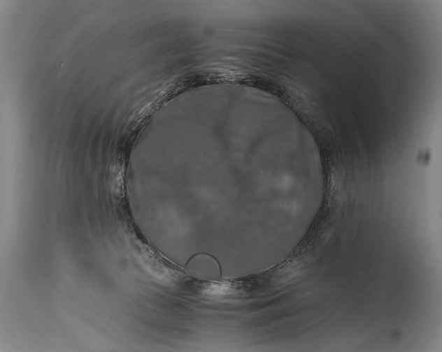 X0000115410177200911171408