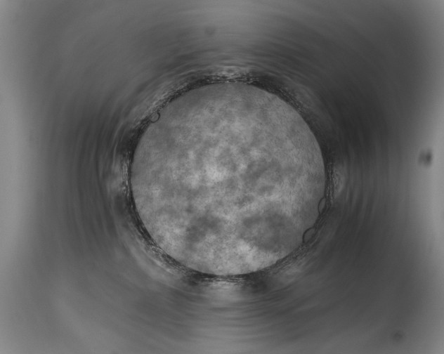 X0000115410236200911171407
