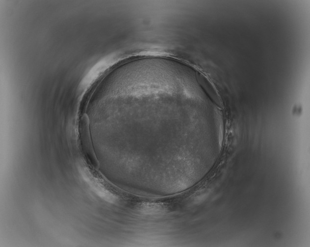 X0000115410296200911171406