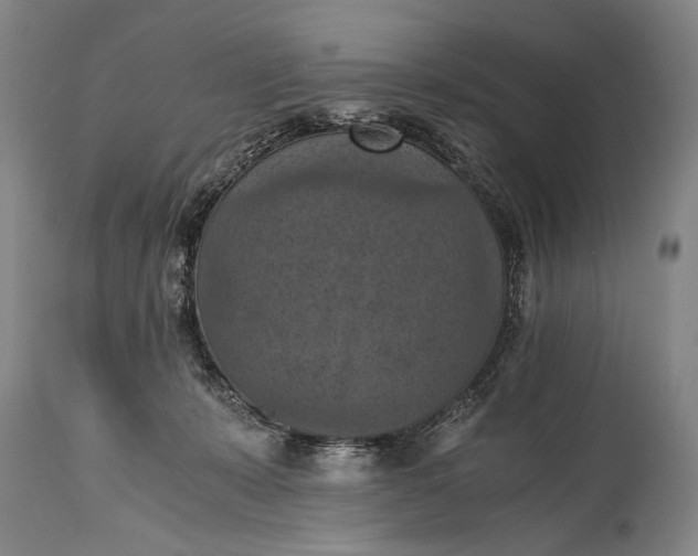 X0000115410319200911171406
