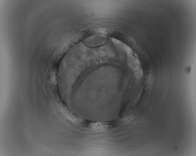 X0000115410331200911171405