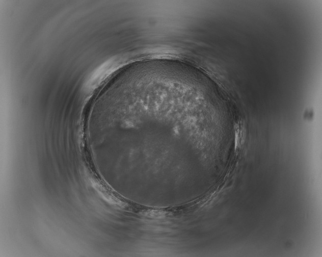 X0000115410339200911171405