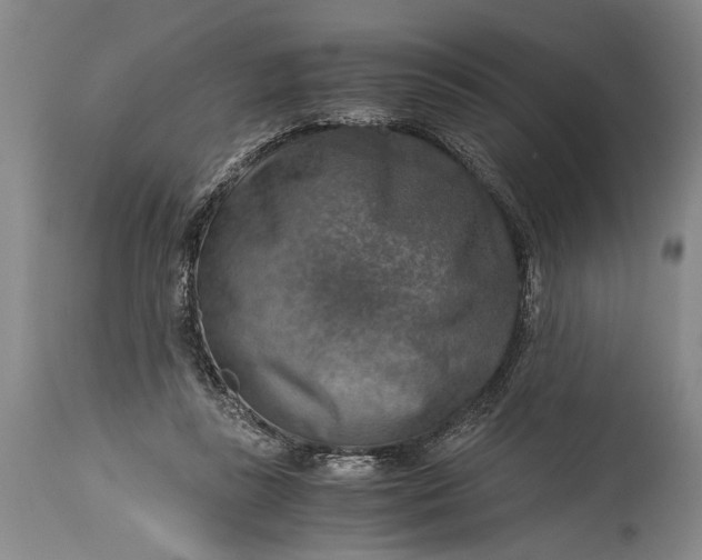 X0000115410355200911171405