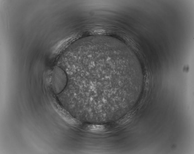X0000115410361200911171405