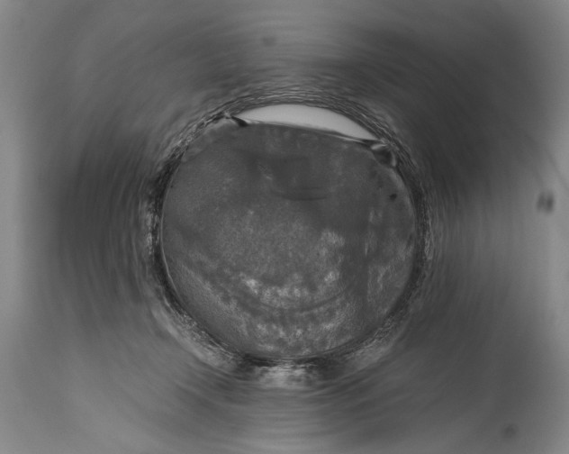 X0000115410366200911171405