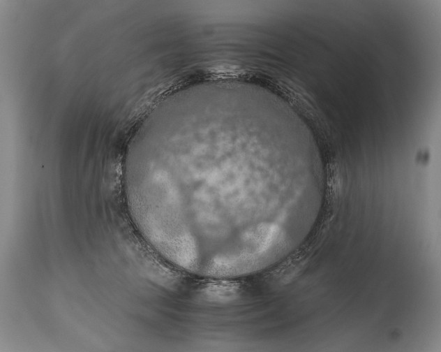 X0000115410369200911171405