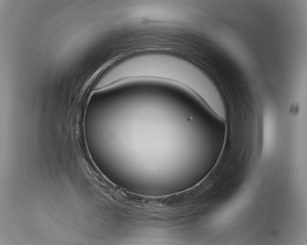 X0000115410387200911171405