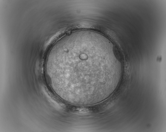 X0000115410395200911171404