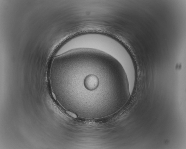 X0000115410399200911171404