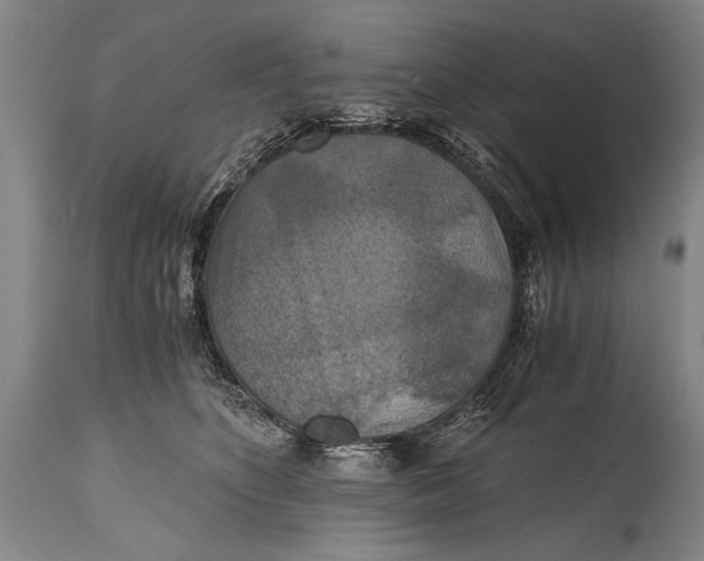 X0000115410516200911171403