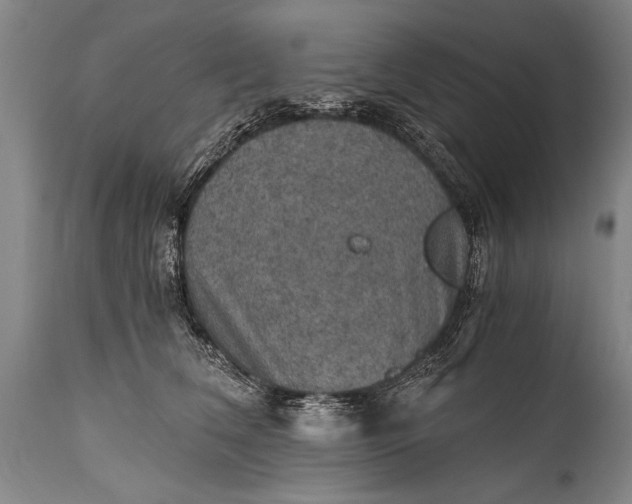 X0000115410612200911171401