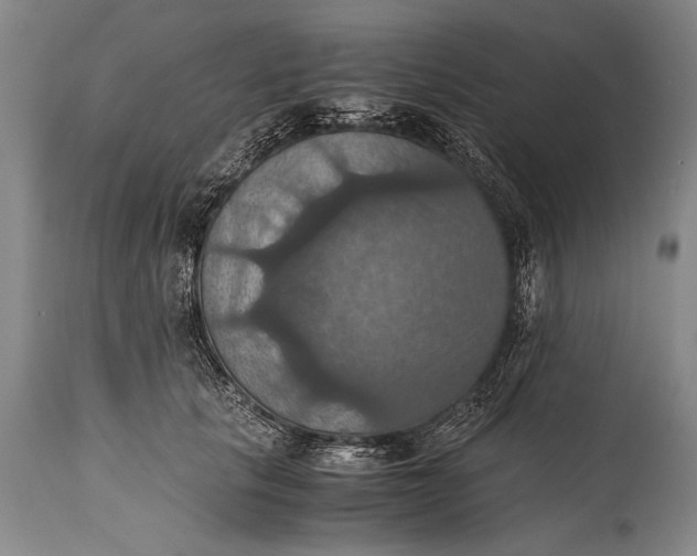 X0000115410657200911171401