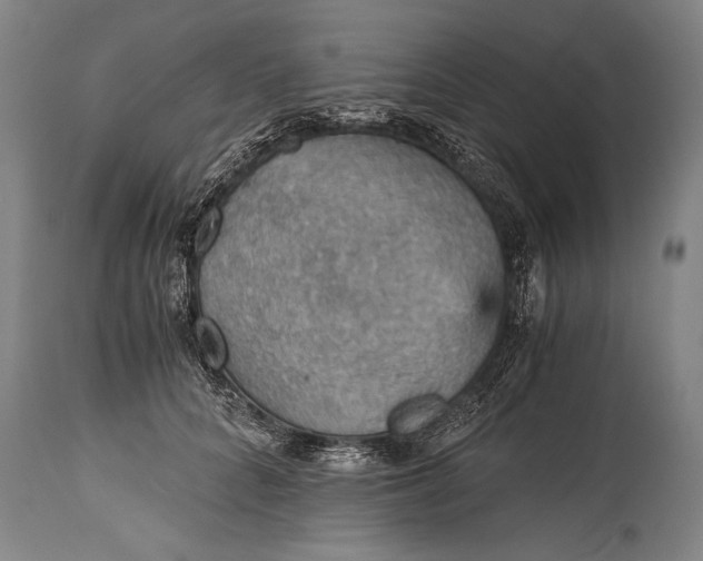 X0000115410704200911171400