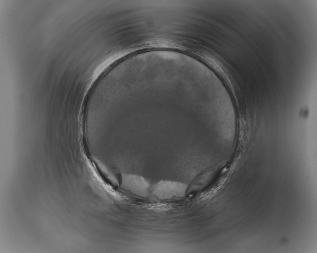 X0000115411141200911171353