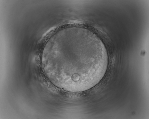 X0000115411254200911171351