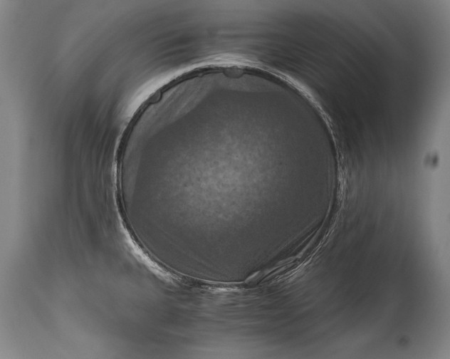 X0000115411335200911171350