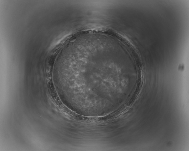 X0000115411399200911171348