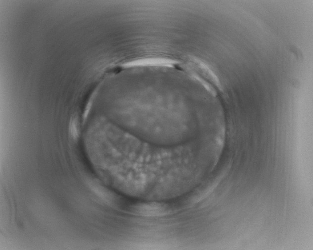 X0000115410069200911241336