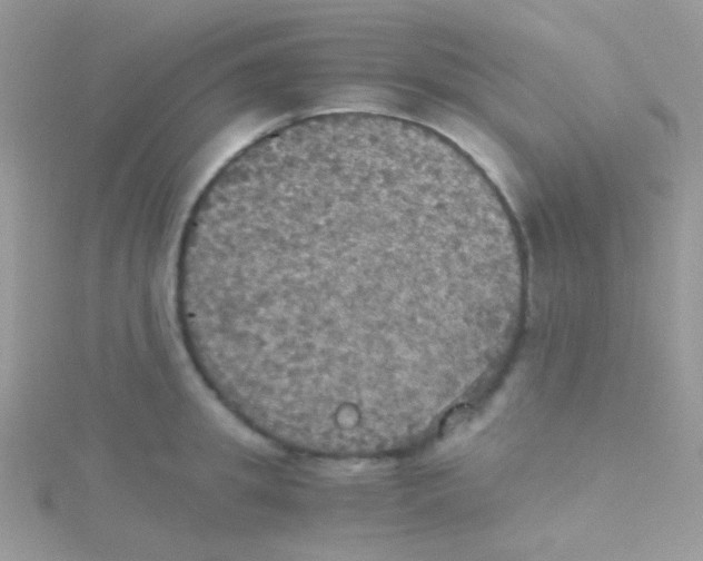 X0000115410949200911241325