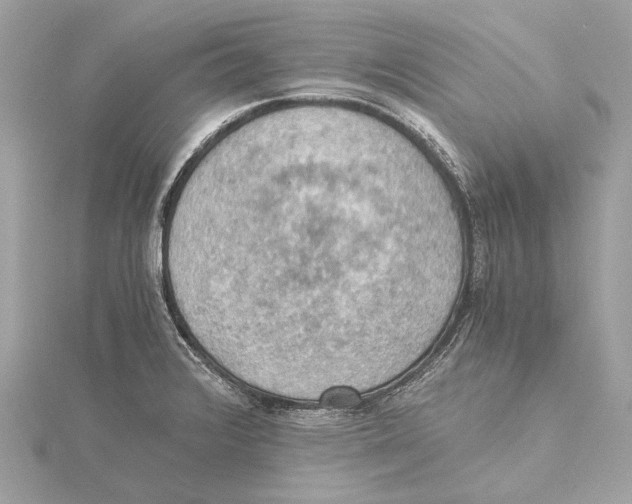 X0000115411376200912011217