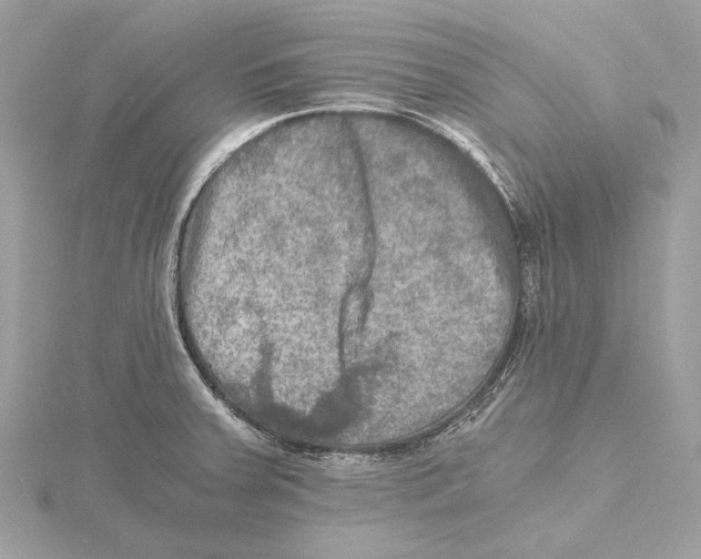 X0000115411379200912011217